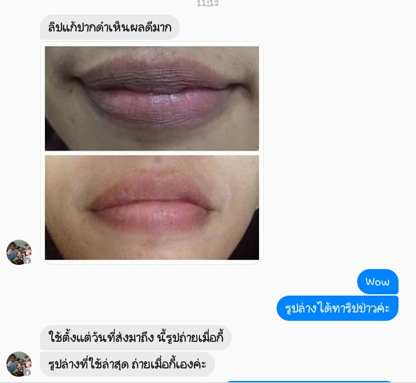 ครีมปากชมพู ใช้ได้ทั้งชายและหญิงตัวนี้ ขายดีมาก ครีมปากชมพู ใช้ได้ทั้งชายและหญิงตัวนี้ ขายดีมาก