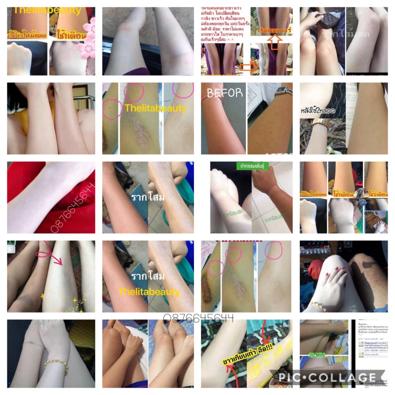 โลชั่นผิวขาวรากโสมสด ครีมรากโสดสด เห็นผลภายใน7วัน โลชั่นผิวขาวรากโสมสด ครีมรากโสดสด เห็นผลภายใน7วัน