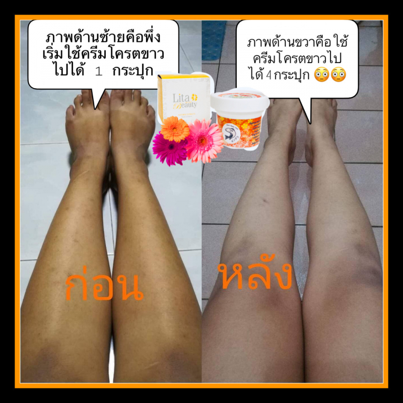 หัวเชื้อครีมโครตขาว โลชั่นผิวขาวเร่งด่วนขาวเร็ว 3 เท่า! โคตรขาว ผิวขาว ออร่าพุ่งใสใน1อาทิต "โลชั่นผิวขาว" ยิ่งทา ยิ่งออร่าพุ่ง!!
