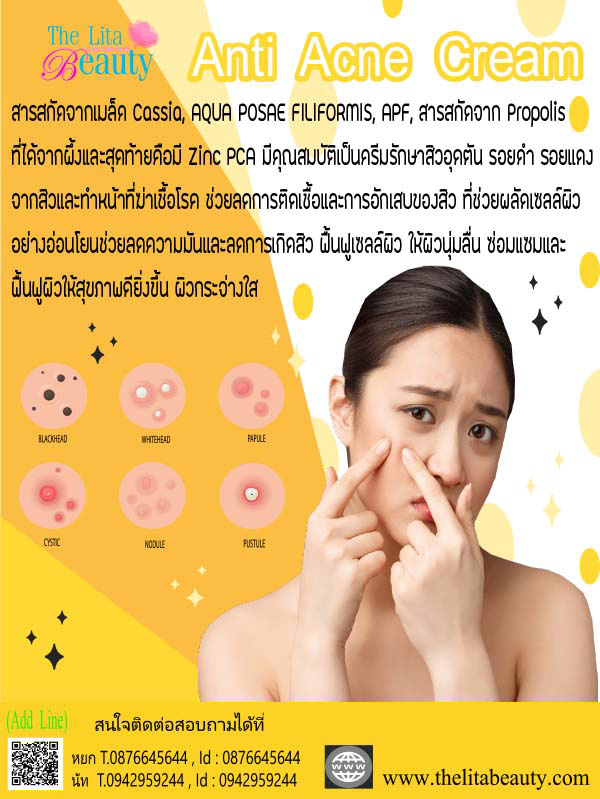 ครีมรักษาสิวตัวเด็ดกู้หน้าสิวให้เป็นหน้าใสทาแล้วสิวอักเสบยุบไว สิวอุดตันหายเกลี้ยงจริงๆ จะทาแค่บริเวณที่เป็นสิวหรือทาทั่วหน้าก็ได้นะคะ เพราะเค้าจะช่วยให้ใบหน้านุ่มชุ่มชื่นขึ้นด้วย ที่สำคัญทาแล้วไม่มีรอยสิวหลงเหลืออีกด้วย โอ๊ย เริ่ด! ครีมรักษาสิวตัวเด็ดกู้หน้าสิวให้เป็นหน้าใสทาแล้วสิวอักเสบยุบไว สิวอุดตันหายเกลี้ยงจริงๆ จะทาแค่บริเวณที่เป็นสิวหรือทาทั่วหน้าก็ได้นะคะ เพราะเค้าจะช่วยให้ใบหน้านุ่มชุ่มชื่นขึ้นด้วย ที่สำคัญทาแล้วไม่มีรอยสิวหลงเหลืออีกด้วย โอ๊ย เริ่ด!