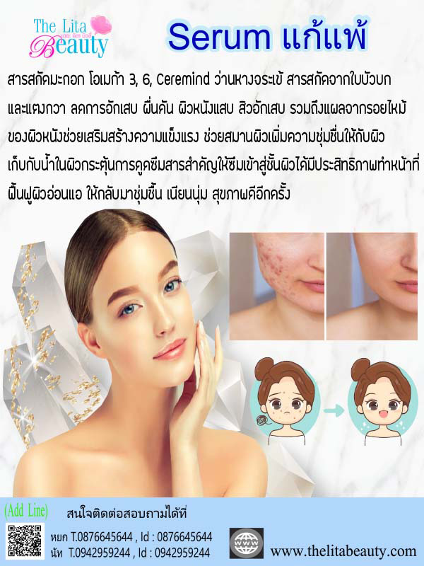 เซรั่มแก้แพ้ เซรั่มแก้แพ้
